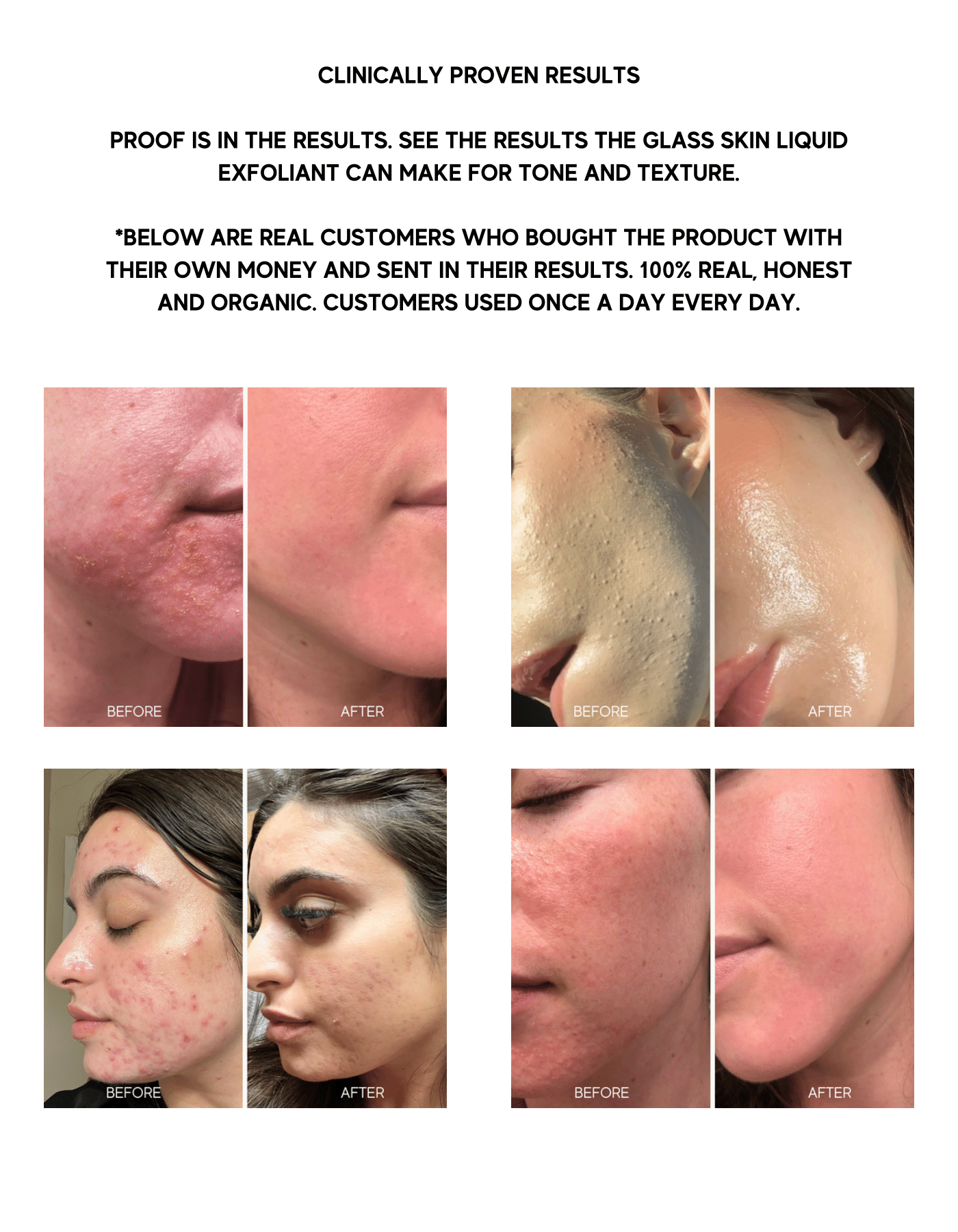 Lumielle - Glass Skin Liquid Exfoliant